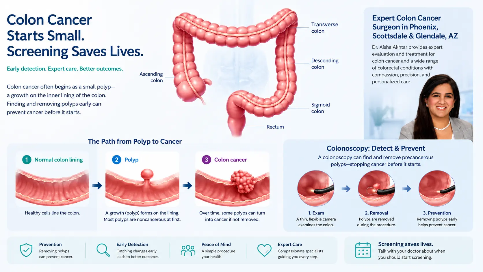 Ilustración sobre detección y prevención del cáncer de colon que muestra pólipos, colonoscopia y atención experta por la Dra. Aisha Akhtar en Phoenix, AZ
